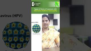 Are WARTS CONTAGIOUS? |Warts Homeopathy Alternative Medicine Cure-Dr.V Bhagyalakshmi|Doctors' Circle