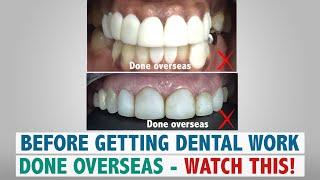 Before Getting Dental Work Done Overseas – Watch This