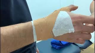 Thumb strain taping for MCP joint