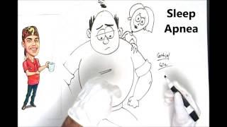 Sleep Apnea Facts Explained Simply