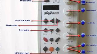 Focus EMG & Nerve Conductions Introduction