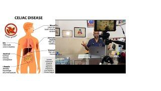 #celiacdisease