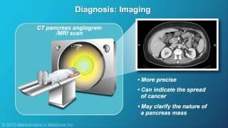 Pancreatic Cancer: Pathophysiology, Diagnosis and Staging