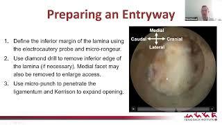 Introduction to Endoscopic Spine Surgery : Peter Derman, MD, MBA