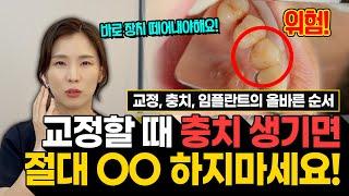 교정 먼저? 충치치료 먼저? 임플란트는 언제? 교정할 때 충치 생기면 절대 OO하지마세요! 교정을 중단해야만하는 '이 상황'은? ㅣ 치아교정과 치과치료의 순서