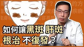 讓黑斑、肝斑根治且不復發的關鍵是？皮膚科林政賢醫師告訴你，如何用矽谷電波進行生態系養膚，打造無斑好膚質！