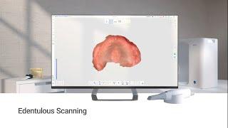 Edentulous Scanning