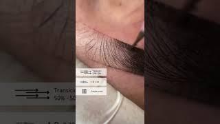 Video about eyebrow PMU with Biomaser needles!