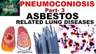 PNEUMOCONIOSIS Part 3: ASBESTOS related lung diseases