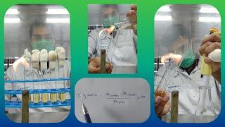 Antimicrobial activity by Broth Dilution Assay with calculations // MIC // IC50 value