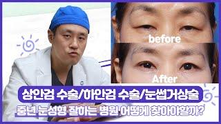 50~ 60대 중년 눈성형 잘하는 병원 찾는 방법 # 상안검수술 # 하안검수술 # 눈썹거상술