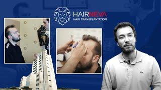 Mehmet's True Hair Transplantation Story From Beginning to End Part