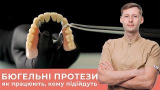 Бюгельний протез - найзручніший серед знімних. З чого він складається і як кріпиться до зубів