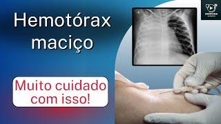 Hemotórax maciço: o que é, como diagnosticar e como tratar.