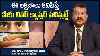 లివర్ క్యాన్సర్ లక్షణాలు || Liver Cancer Symptoms in Telugu || Dr DVL Narayan Rao || TX Hospitals