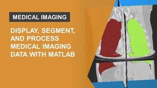 Display, Segment, and Process Medical Imaging Data with MATLAB