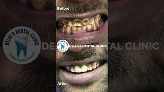 Delhi 5 Dental Clinic | Cases of the year | LINK IN DESCRIPTION | Part 2