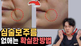 무조건 효과보는 심술보 없애는 방법!! | 마리오네트 주름, 입꼬리 처짐, 불독살