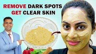 Remove Dark Spots and Get Clear Skin Naturally At Home - Dr. Vivek Joshi