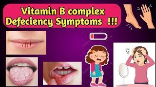 Vitamin B Complex Defeciency Symptoms.