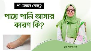 পায়ে পানি আসা বা ফোলে যাওয়ার কারণ কি? Edema: Causes, Symptoms & Treatment