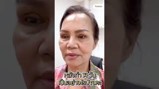 คุณแม่หนังตาตก แก้ด่วนเลยค่ะหมอ!  | รณภีร์คลินิก