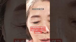 눈가주름이 사라지고#새살솔솔~/눈가주름.눈가꺼짐을 빠르게 재생시키는 아이패치#