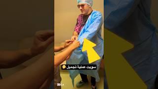 سويت عملية تجميل ! #shorts