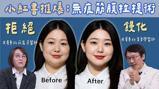 無痕筋膜拉提術是真的！拒絕饅化臉！微整形權威黃勇學醫師告訴你三個秘訣！