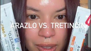 Arazlo vs. Tretinoin: what’s the difference?