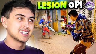 Why LESION Is The BEST OPERATOR... (Rainbow Six Siege)