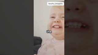 Progeria Hutchinson Gilford Progeria Syndrome