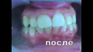 Стоматолог - ортодонт в Новосибирске в клинике Блеск