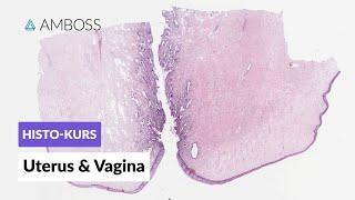 Histologie Uterus, Zervix und Vagina - Mikroskopische Anatomie - AMBOSS Video