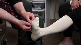 Wound Care with Cornerstone Prosthetics