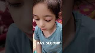 Mobile effect on child eye l Eye strain  #shorts #ytshorts #comedy #viral