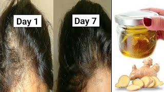 How To Make Ginger Hair Growth Oil To Regrow Your Hair At Speed Of A Rocket | Hair Growth Oil