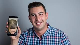 Bosley Consultation and Free Personal Hair Analysis Experience