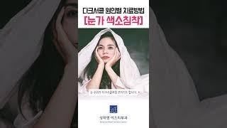 다크서클의 원인별 치료방법이 다르다!?