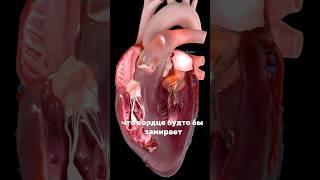 Экстрасистолы были у всех? #здоровье #медицина