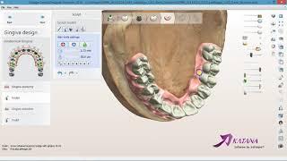 How to design an artificial gingiva for hybrid implants bridge in 3Shape