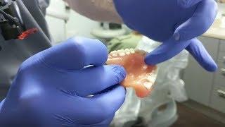 Creating a Denture Scan Appliance