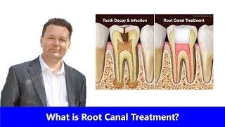 Root Canal Treatment A Step by Step By Dr Marcus Spry