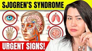 10 Alarming Sjogren's Syndrome Symptoms You Should Know