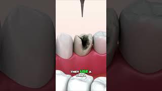 “What’s Really Hiding on Your Teeth” #shorts #viral #trending #foryou #foryoupage #viralshorts