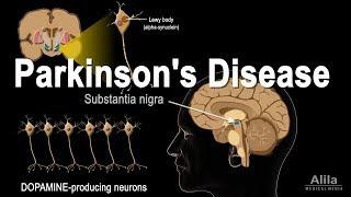 Parkinson's Disease, Animation