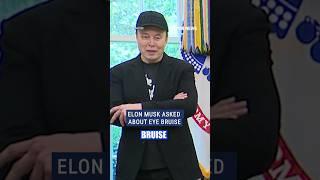 OUCH: Elon Musk says eye bruise was caused by punch from his son X #foxnews #news #shorts