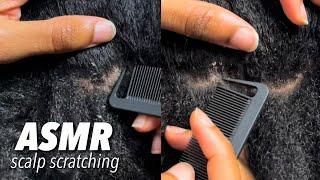 ASMR Scalp Scratching to help you relax‍️