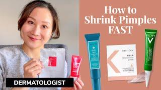 Dermatologist Guide to Shrinking Pimples and Zits FAST