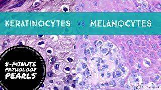 Melanocytes vs Keratinocytes Made Easy: 5-Minute Pathology Pearls